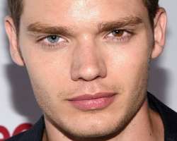 He is a patient of Heterochromia due to this one of his eye is blue while the other eye is half blue and half brown.